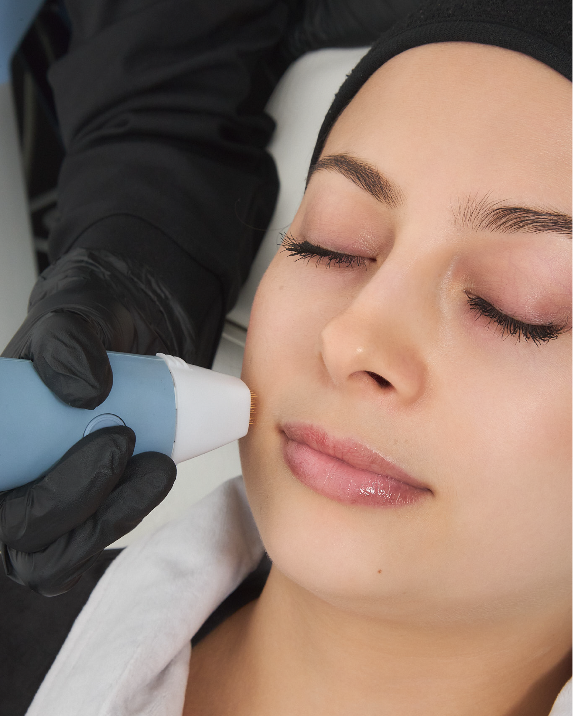 EXION FRACCIONADO FACIAL