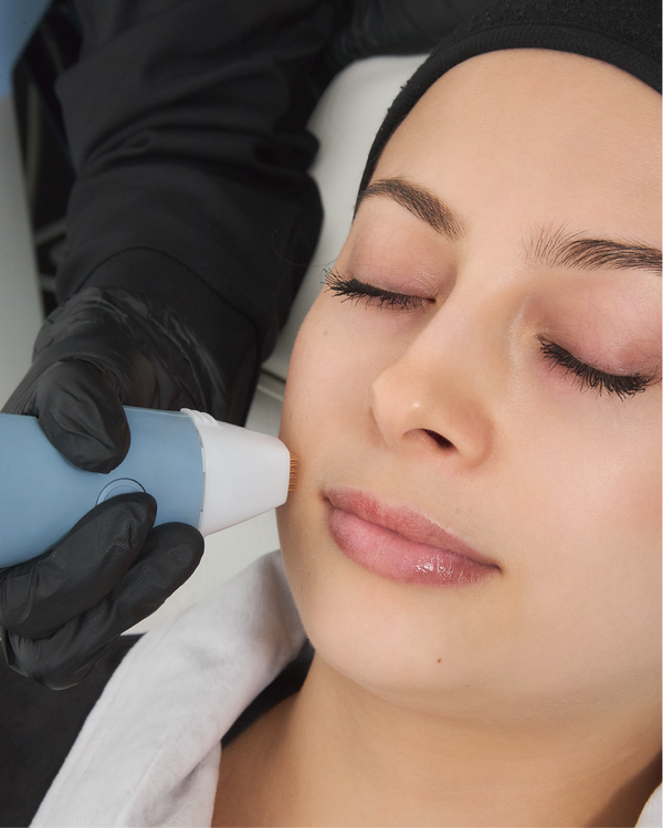 Exion Fraccionado Facial
