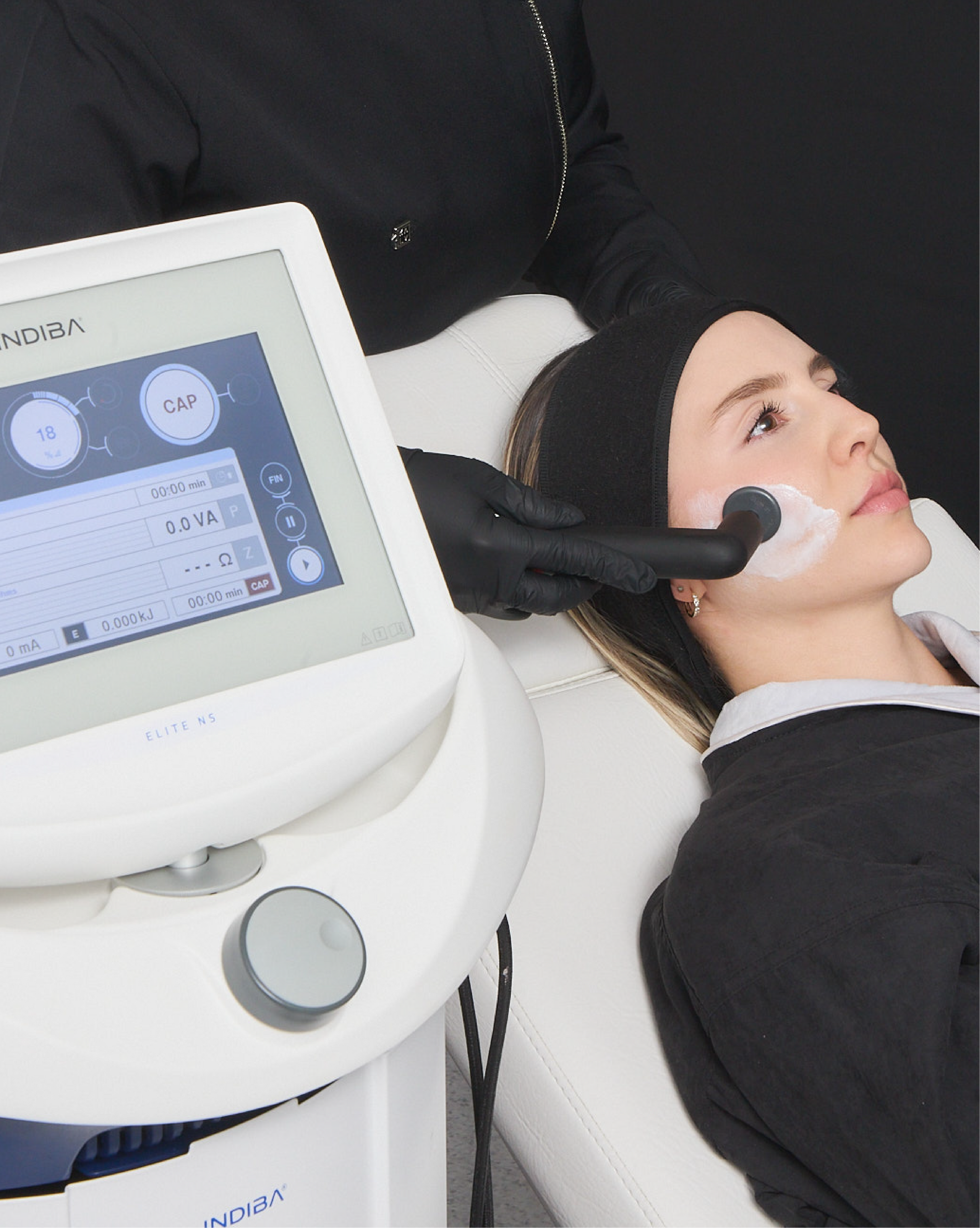 INDIBA FACIAL — 8 SESIONES