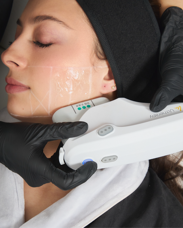 ULTHERAPY PRIME